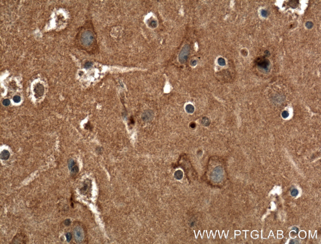 Immunohistochemistry (IHC) staining of human brain tissue using CACNA1A Polyclonal antibody (27227-1-AP)