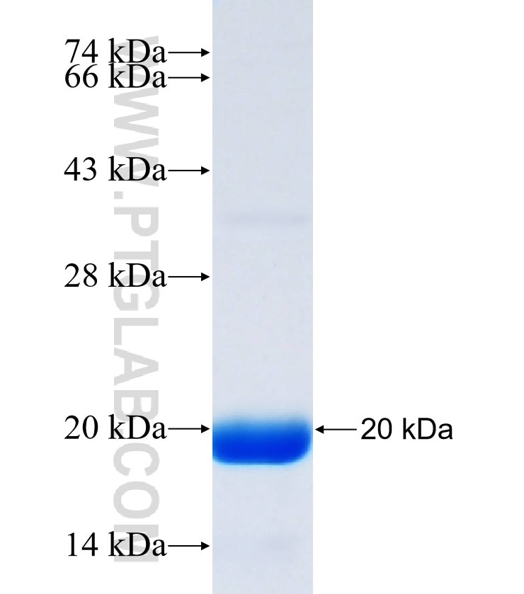 CACNA1A fusion protein Ag33902 SDS-PAGE