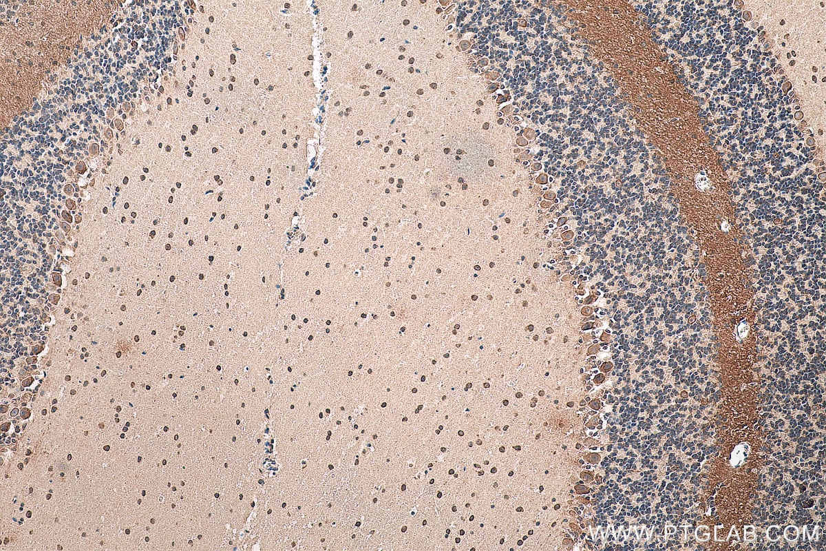 Immunohistochemistry (IHC) staining of mouse cerebellum tissue using CACNA1B Polyclonal antibody (19681-1-AP)