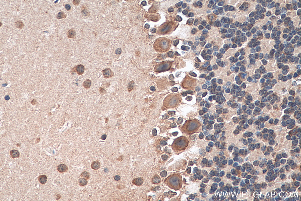 Immunohistochemistry (IHC) staining of mouse cerebellum tissue using CACNA1B Polyclonal antibody (19681-1-AP)