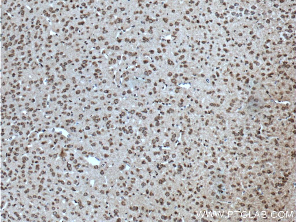 Immunohistochemistry (IHC) staining of mouse brain tissue using CACNA1B Polyclonal antibody (19681-1-AP)