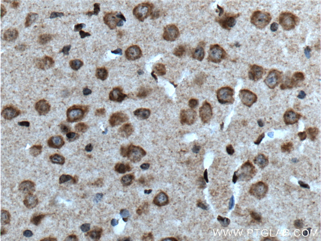 Immunohistochemistry (IHC) staining of mouse brain tissue using CACNA1B Polyclonal antibody (19681-1-AP)