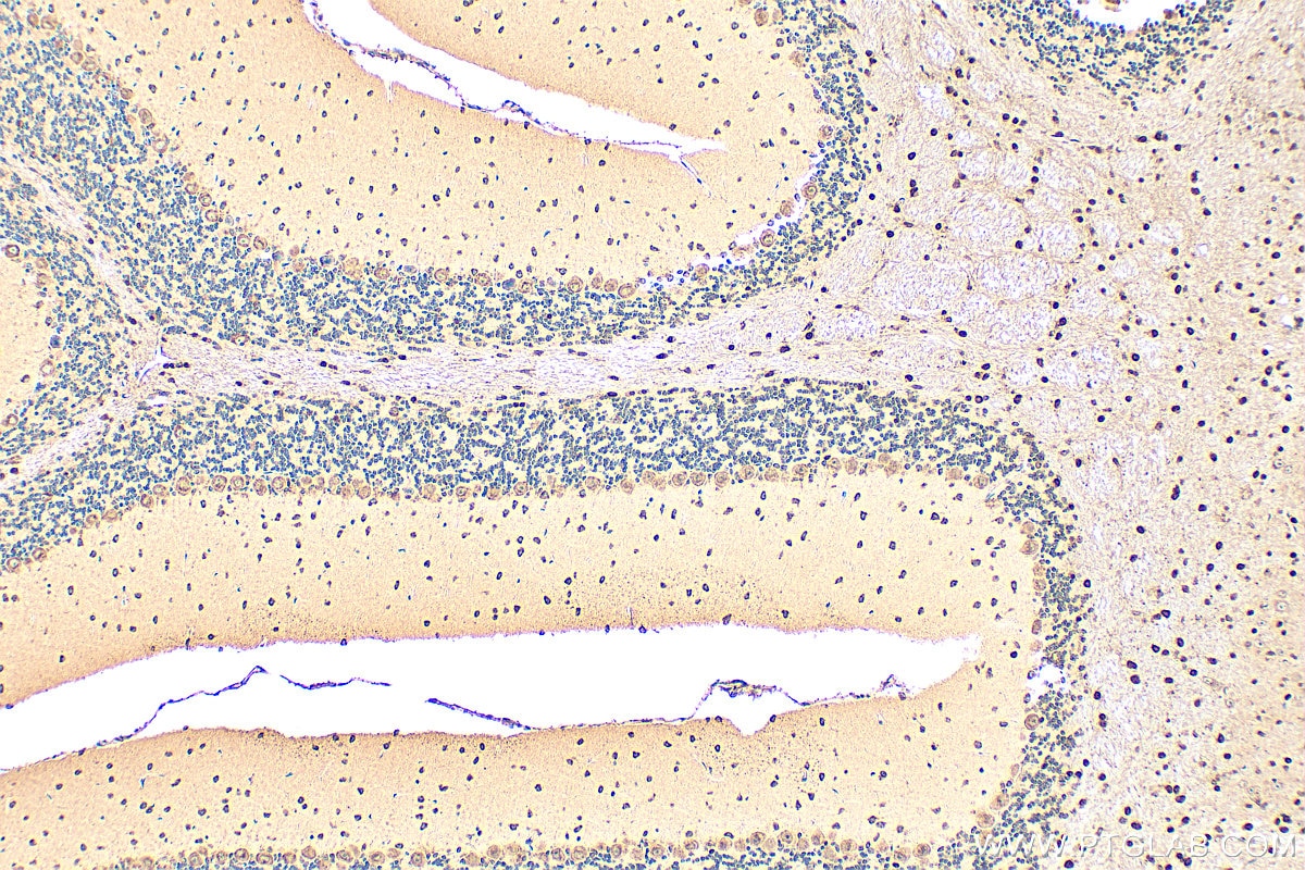 Immunohistochemistry (IHC) staining of mouse cerebellum tissue using CACNA1B Polyclonal antibody (19681-1-AP)