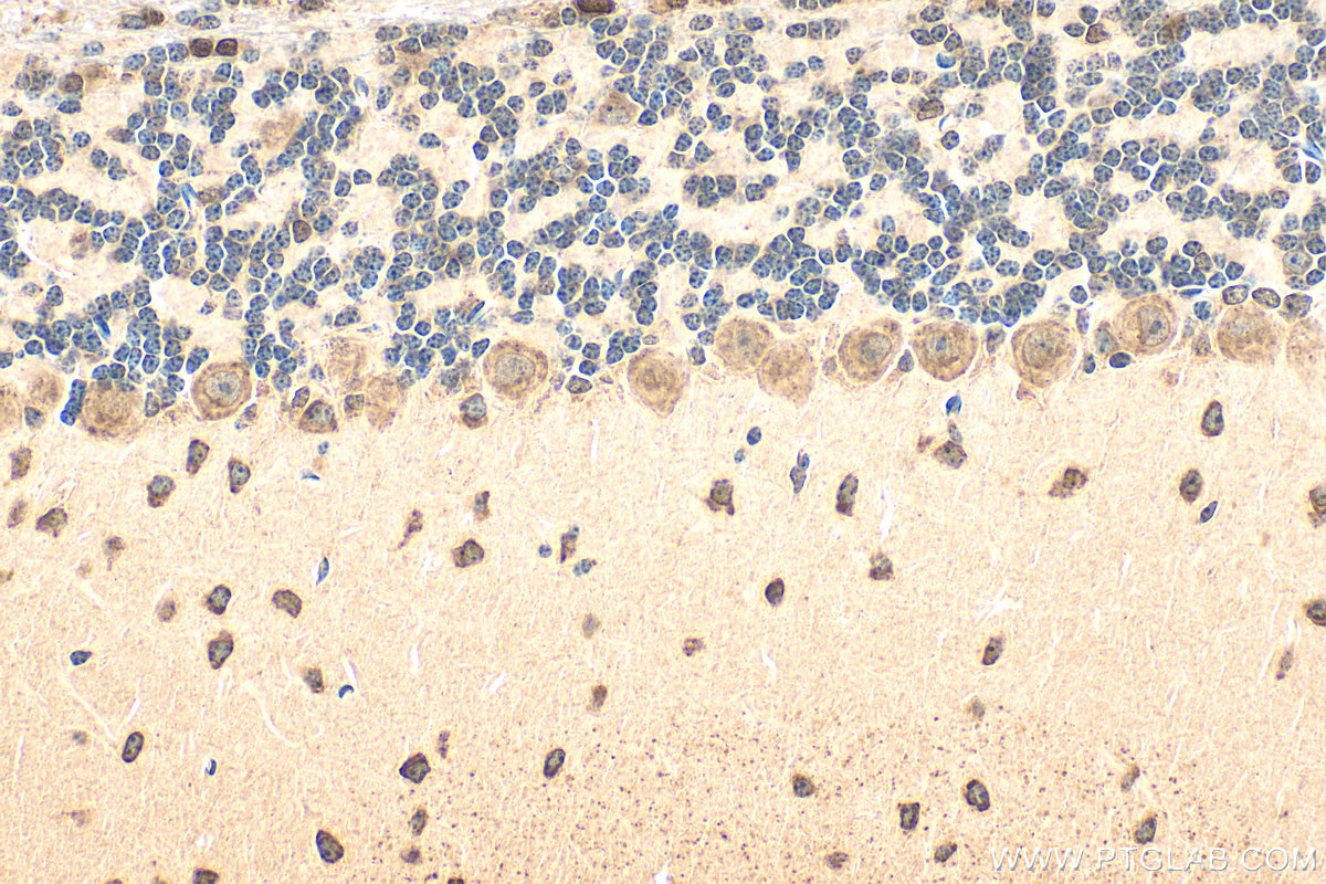 Immunohistochemistry (IHC) staining of mouse cerebellum tissue using CACNA1B Polyclonal antibody (19681-1-AP)