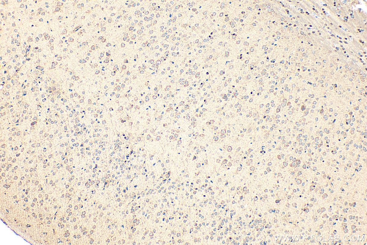 Immunohistochemistry (IHC) staining of mouse brain tissue using CACNA1B Polyclonal antibody (19681-1-AP)