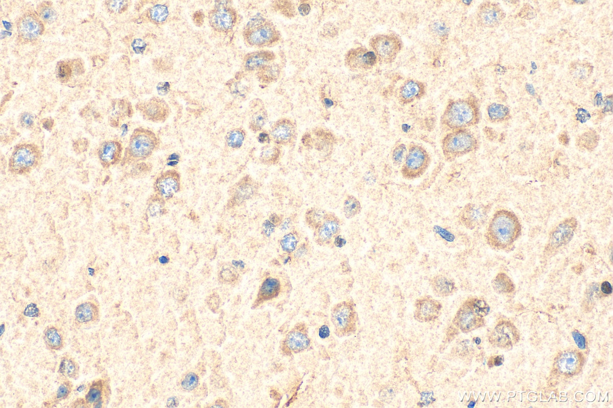 Immunohistochemistry (IHC) staining of mouse brain tissue using CACNA1B Polyclonal antibody (19681-1-AP)