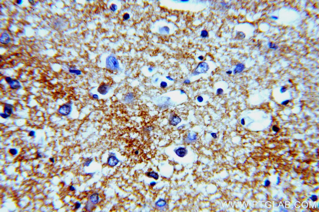 CACNA1B Polyclonal antibody