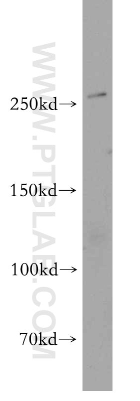 CACNA1B Polyclonal antibody