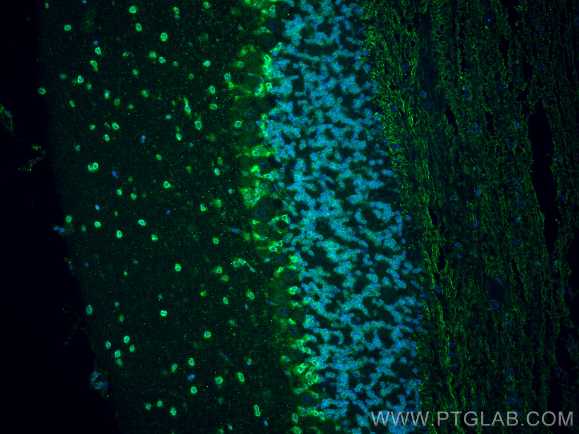 Immunofluorescent analysis of (4% PFA) fixed paraffin-embedded mouse cerebellum tissue using CACNA1B antibody (30625-1-AP) at dilution of 1:200 and CoraLite®488-Conjugated Goat Anti-Rabbit IgG(H+L) (SA00013-2). Heat mediated antigen retrieval with Tris-EDTA buffer (pH 9.0). Immunofluorescence (IF) / fluorescent staining of mouse cerebellum tissue using CACNA1B Polyclonal antibody (30625-1-AP)
