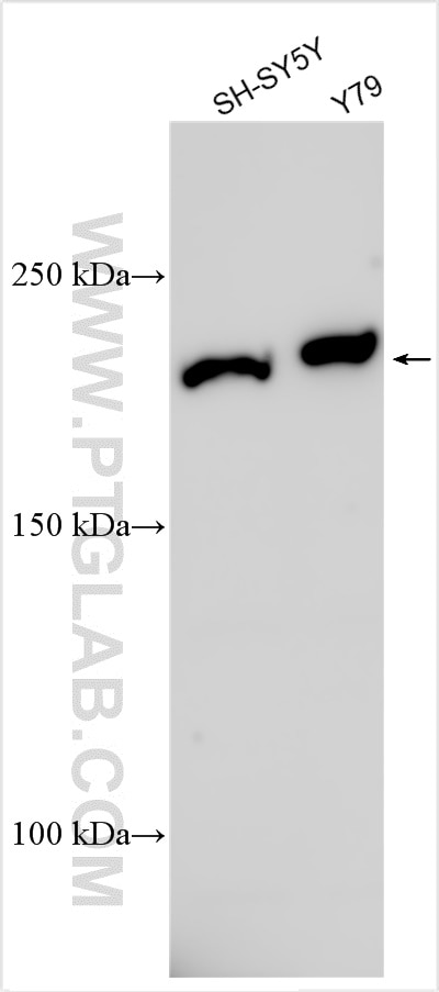 Western Blot (WB) analysis of various lysates using CACNA1B Polyclonal antibody (30625-1-AP)