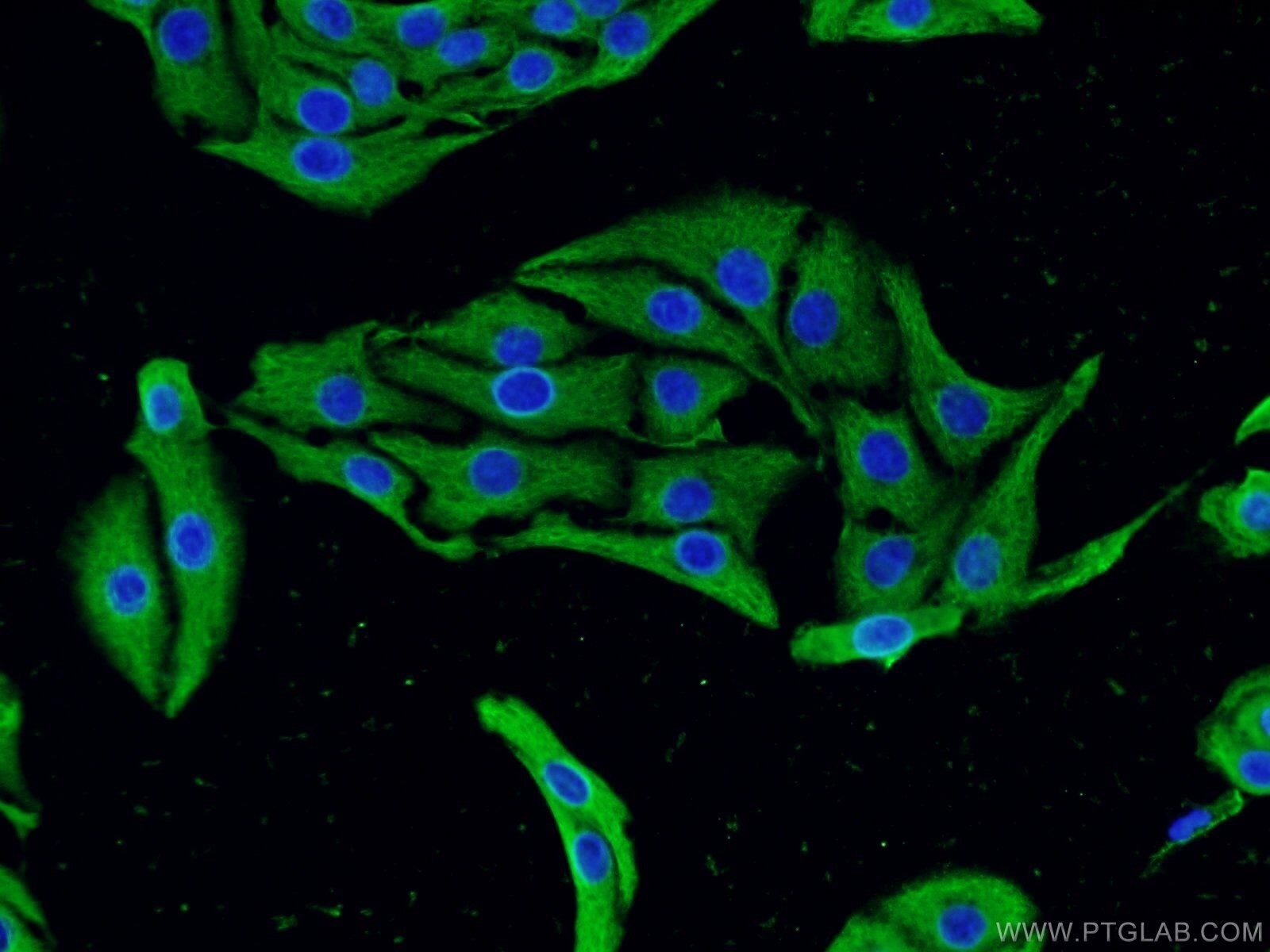 IF Staining of SH-SY5Y using 22276-1-AP