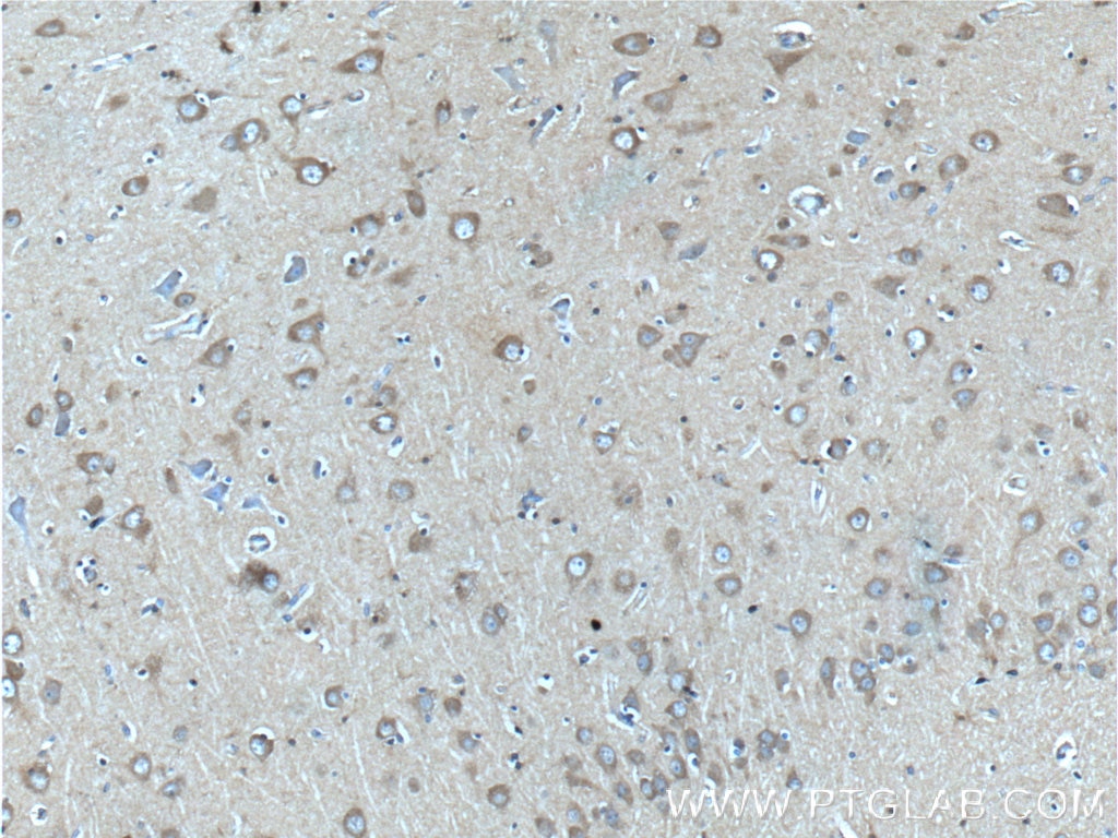 Immunohistochemistry (IHC) staining of human brain tissue using CACNA1D Polyclonal antibody (22276-1-AP)