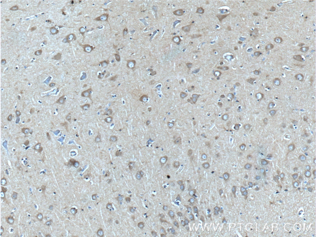 IHC staining of human brain using 22276-1-AP