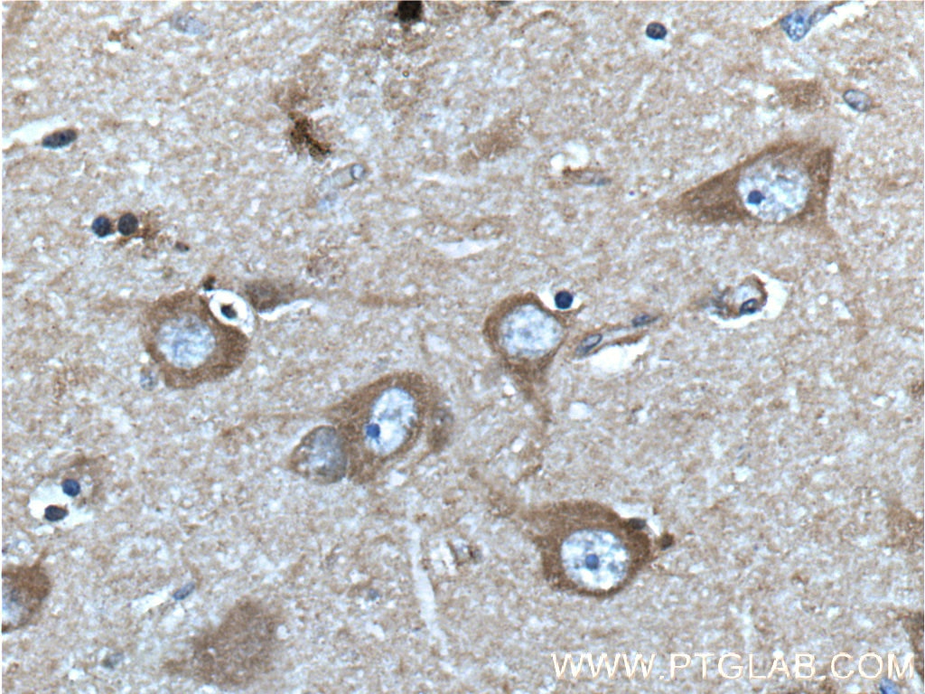 IHC staining of human brain using 22276-1-AP