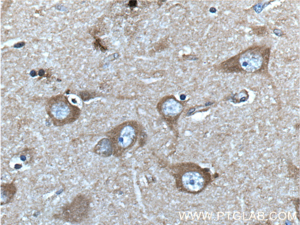 Immunohistochemistry (IHC) staining of human brain tissue using CACNA1D Polyclonal antibody (22276-1-AP)