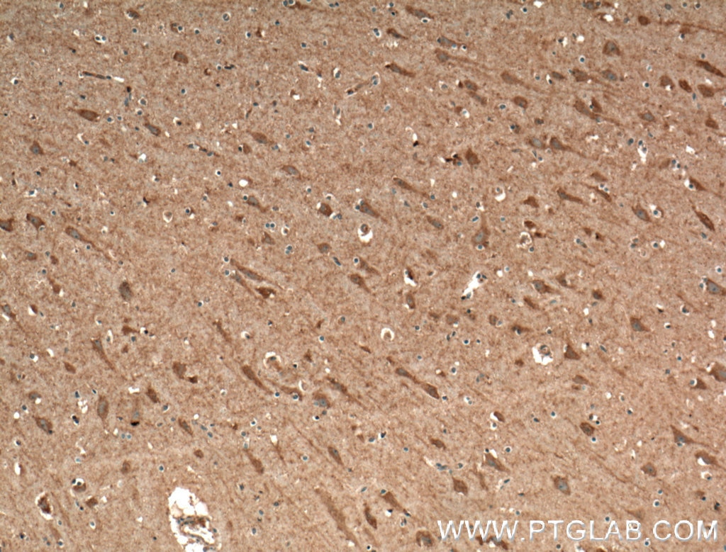 Immunohistochemistry (IHC) staining of human brain tissue using CACNA1E Polyclonal antibody (27225-1-AP)