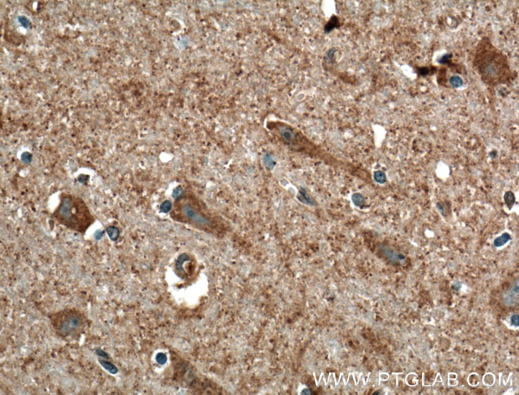 Immunohistochemistry (IHC) staining of human brain tissue using CACNA1E Polyclonal antibody (27225-1-AP)