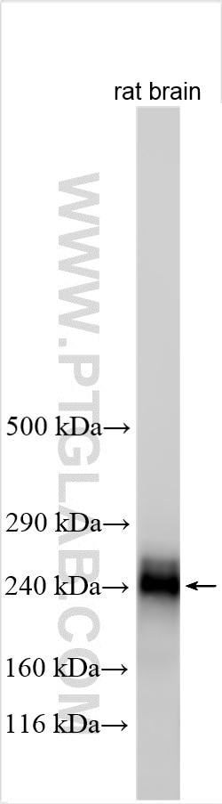 Western Blot (WB) analysis of various lysates using CACNA1E Polyclonal antibody (27225-1-AP)