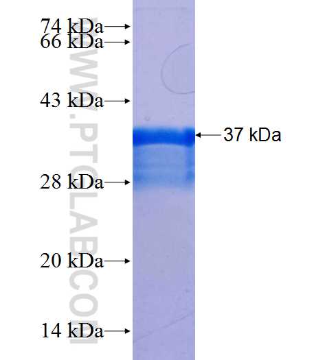 CACNA1E fusion protein Ag25944 SDS-PAGE