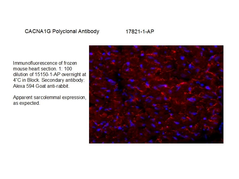 Immunofluorescence (IF) / fluorescent staining of mouse heart tissue using CACNA1G Polyclonal antibody (17821-1-AP)