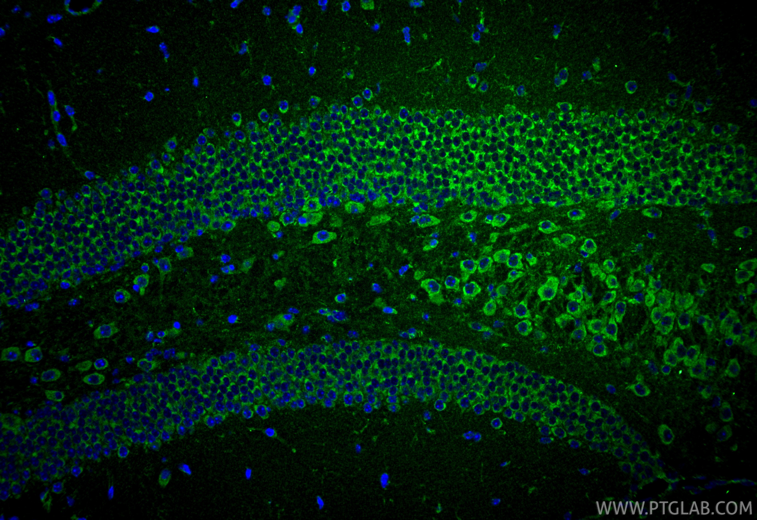 Immunofluorescence (IF) / fluorescent staining of mouse brain tissue using CACNA1G Polyclonal antibody (17821-1-AP)