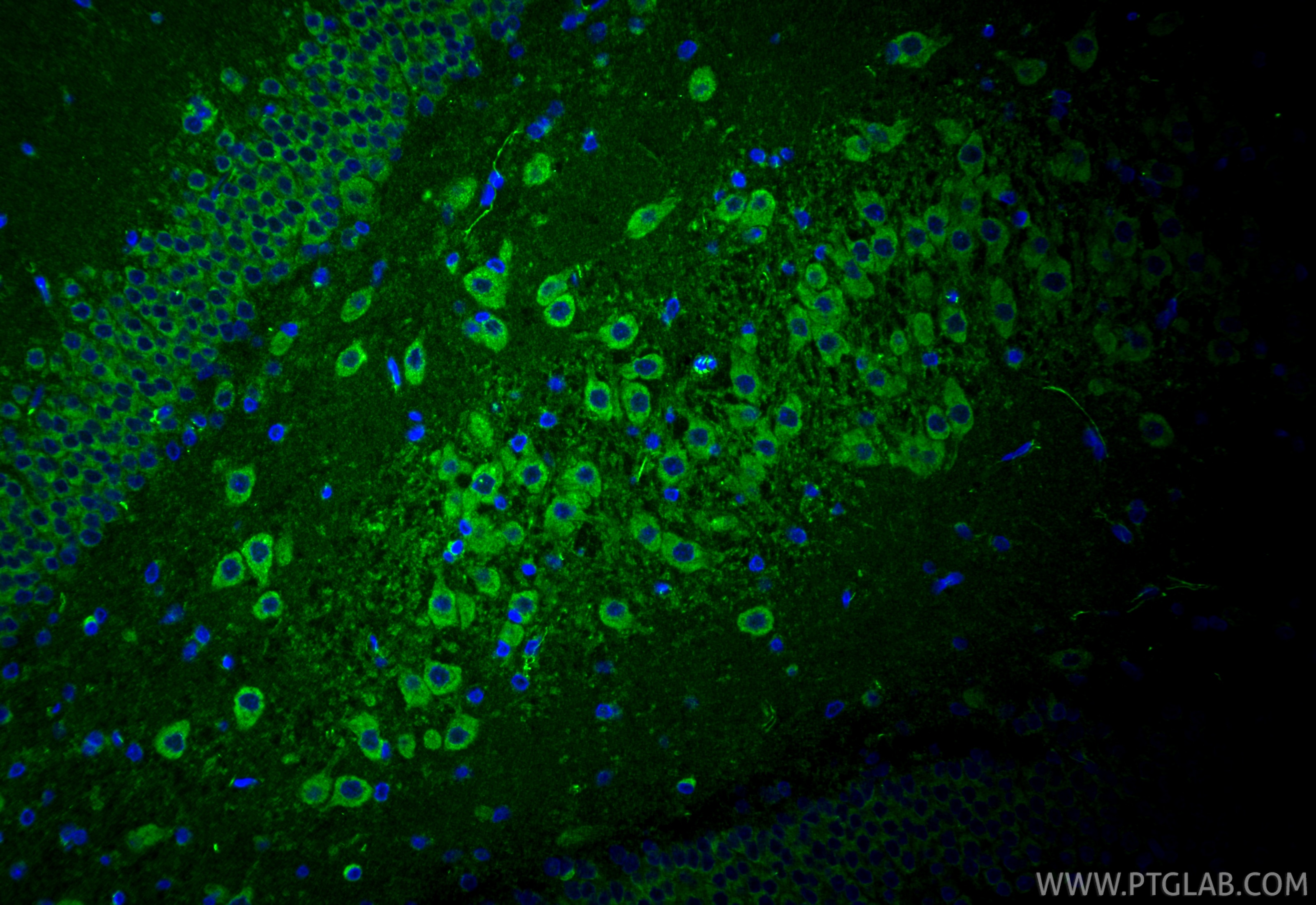 Immunofluorescence (IF) / fluorescent staining of rat brain tissue using CACNA1G Polyclonal antibody (17821-1-AP)