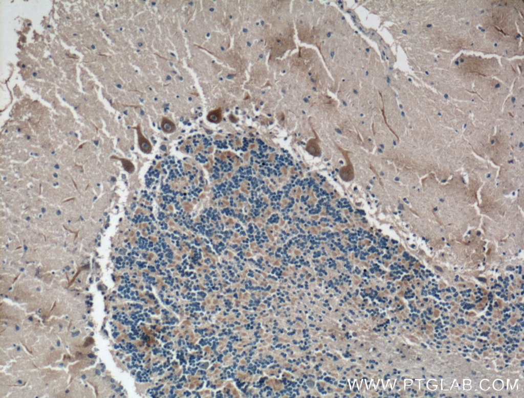 IHC staining of human cerebellum using 17821-1-AP