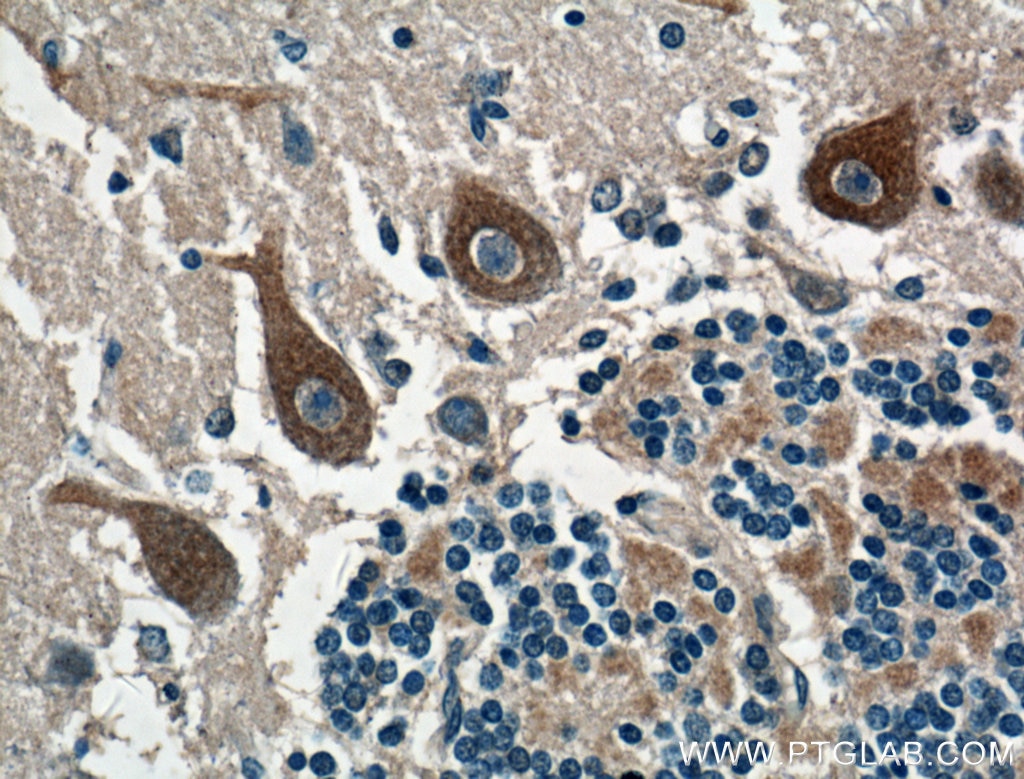 Immunohistochemistry (IHC) staining of human cerebellum tissue using CACNA1G Polyclonal antibody (17821-1-AP)
