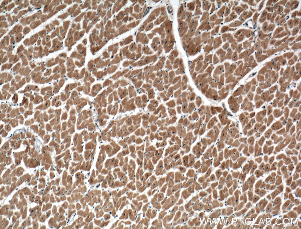 Immunohistochemistry (IHC) staining of human heart tissue using CACNA1G Polyclonal antibody (17821-1-AP)