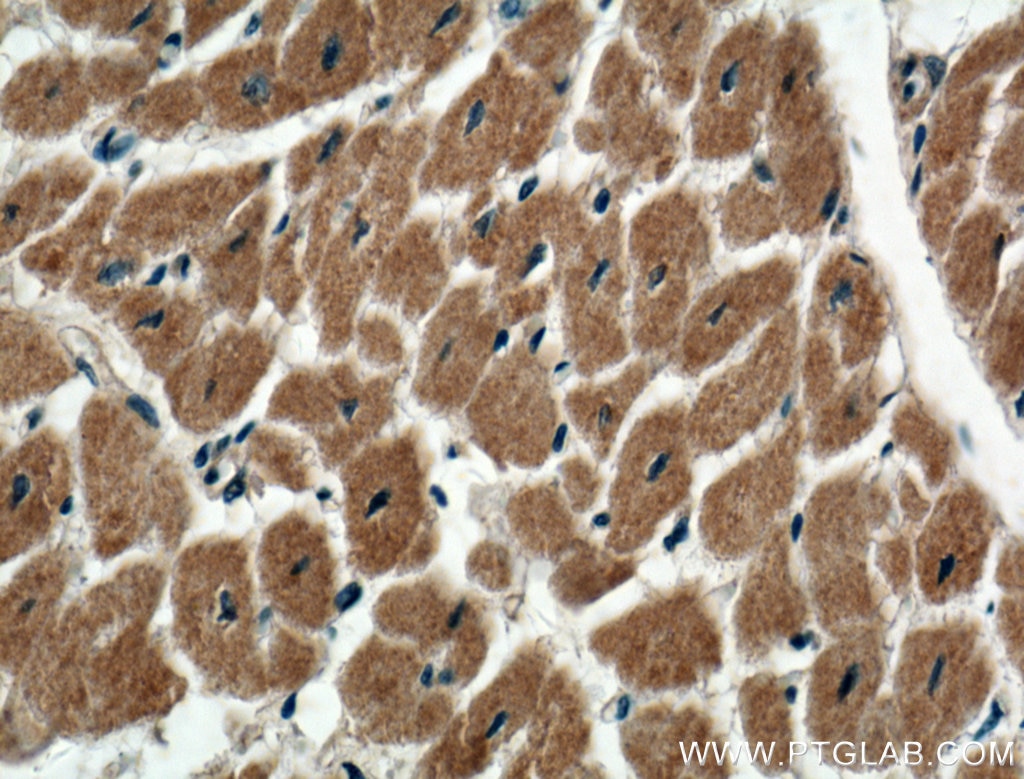 Immunohistochemistry (IHC) staining of human heart tissue using CACNA1G Polyclonal antibody (17821-1-AP)