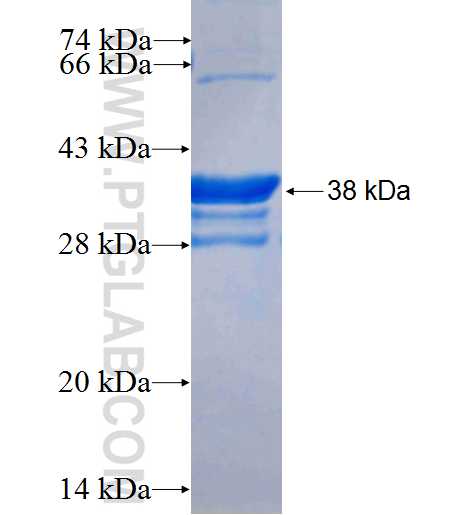 CACNA1H fusion protein Ag26094 SDS-PAGE