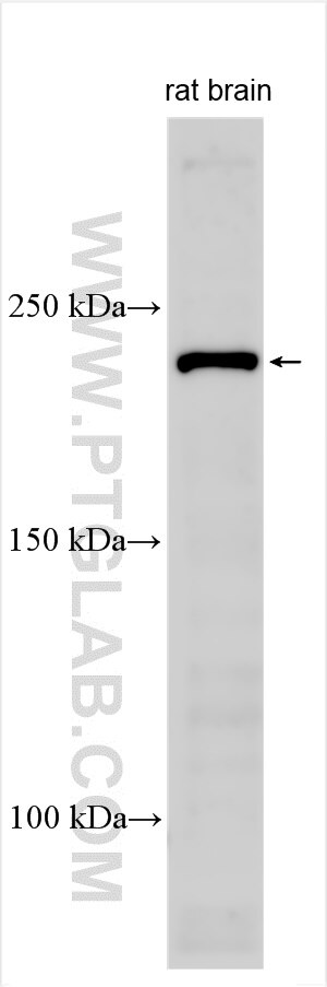 Western Blot (WB) analysis of various lysates using CACNA1I-Specific Polyclonal antibody (19534-1-AP)