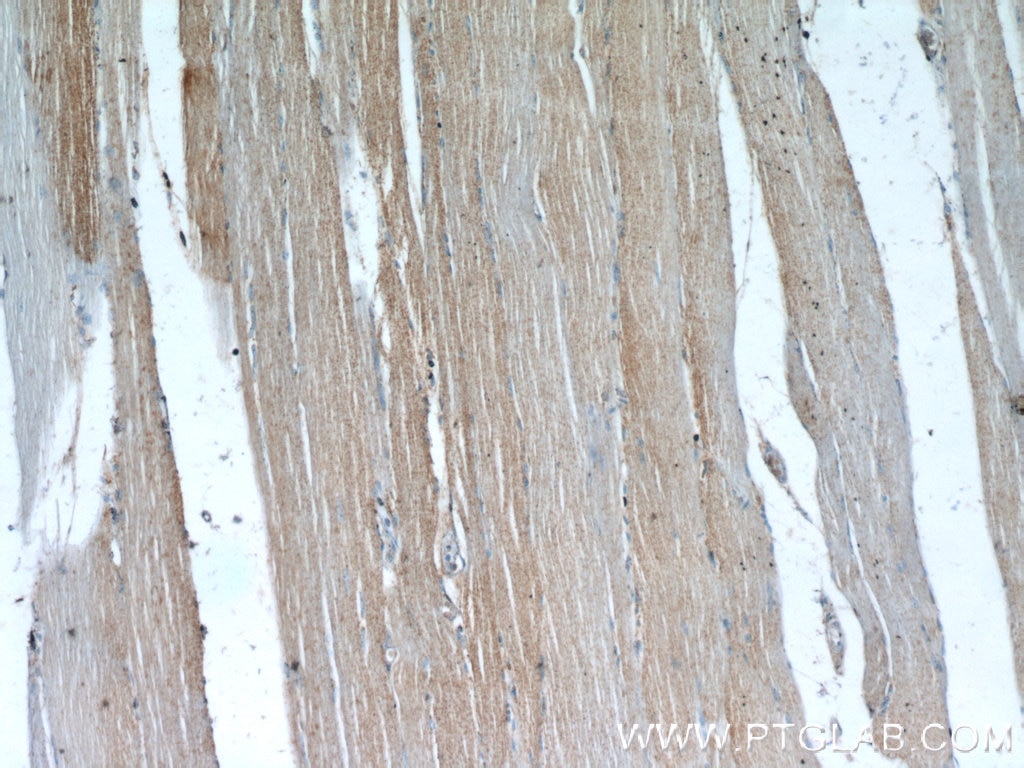 Immunohistochemistry (IHC) staining of human skeletal muscle tissue using CACNA1S Polyclonal antibody (22279-1-AP)