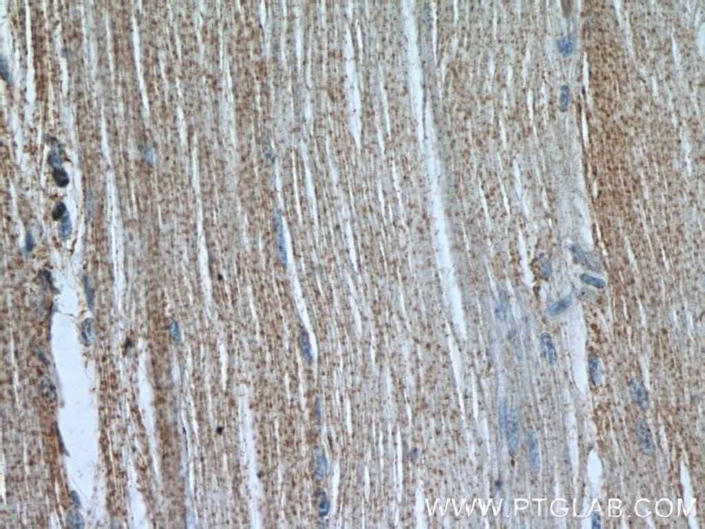 Immunohistochemistry (IHC) staining of human skeletal muscle tissue using CACNA1S Polyclonal antibody (22279-1-AP)