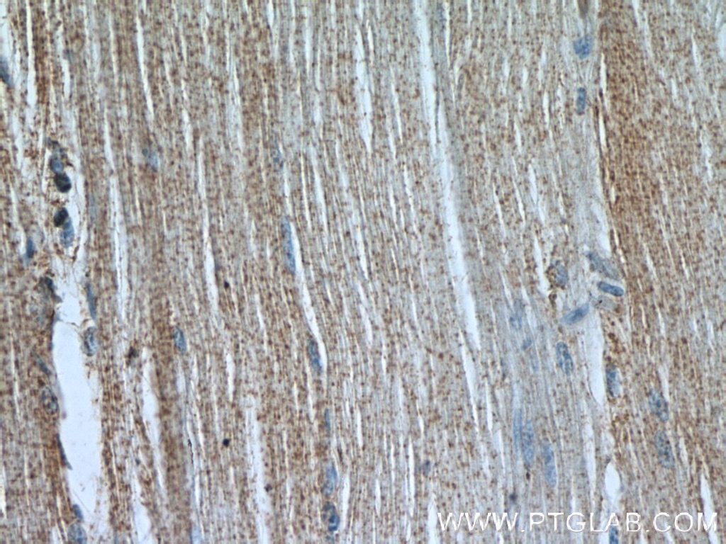 CACNA1S Polyclonal antibody