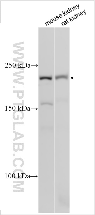 Western Blot (WB) analysis of various lysates using CACNA1S Polyclonal antibody (22279-1-AP)