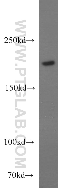 Western Blot (WB) analysis of human brain tissue using CACNA1S Polyclonal antibody (22279-1-AP)