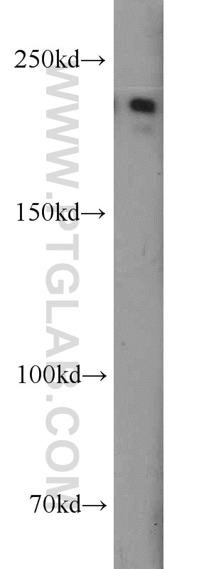 Western Blot (WB) analysis of human brain tissue using CACNA1S Polyclonal antibody (22279-1-AP)