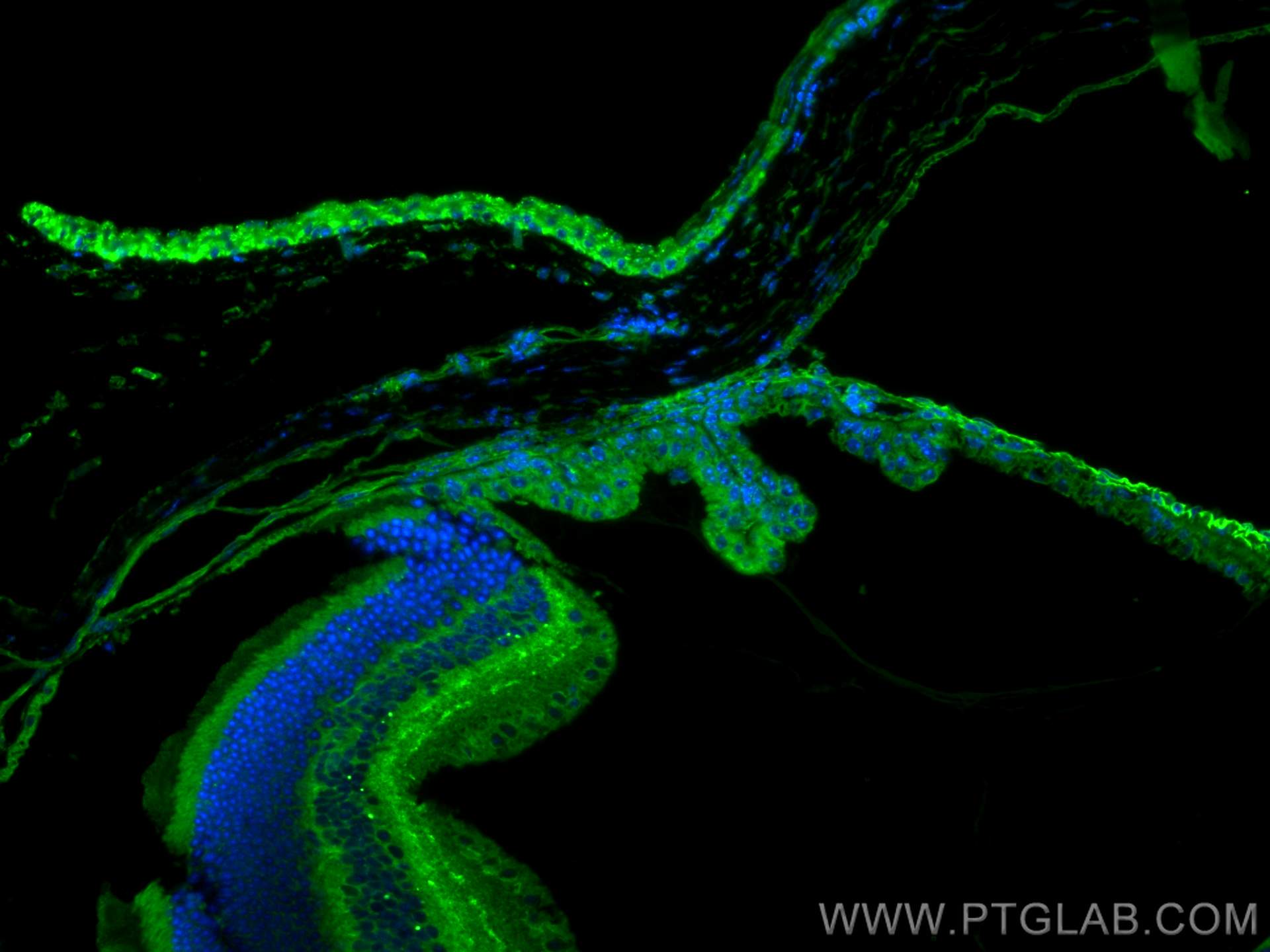 Immunofluorescence (IF) / fluorescent staining of mouse eye tissue using CACNA2D1 Polyclonal antibody (27453-1-AP)