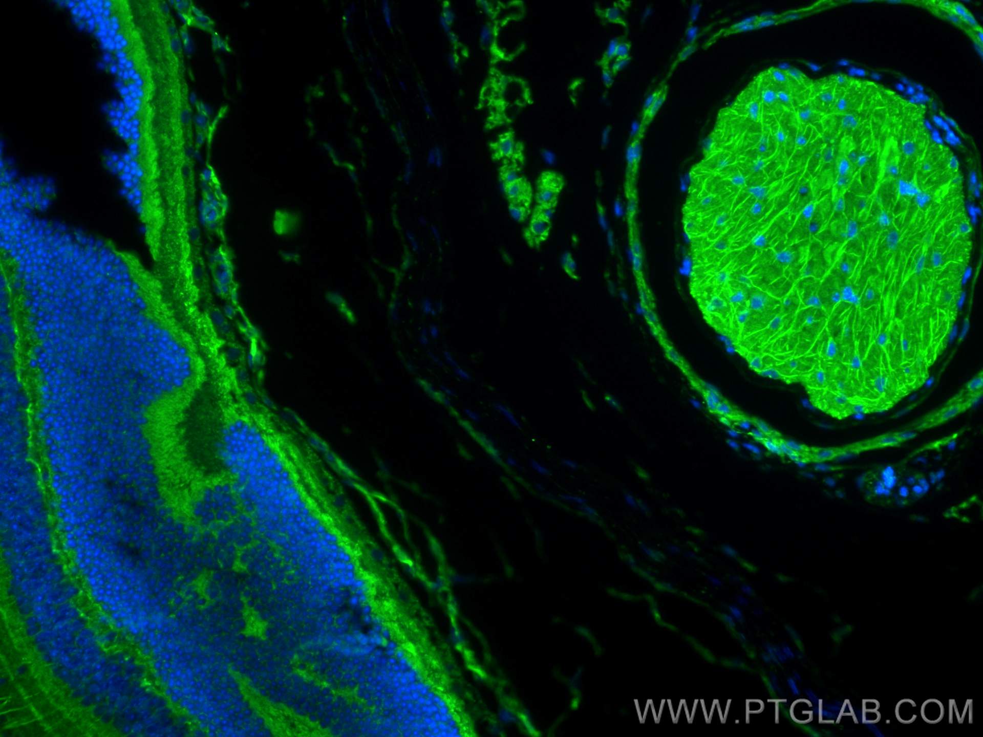 Immunofluorescence (IF) / fluorescent staining of mouse eye tissue using CACNA2D1 Polyclonal antibody (27453-1-AP)