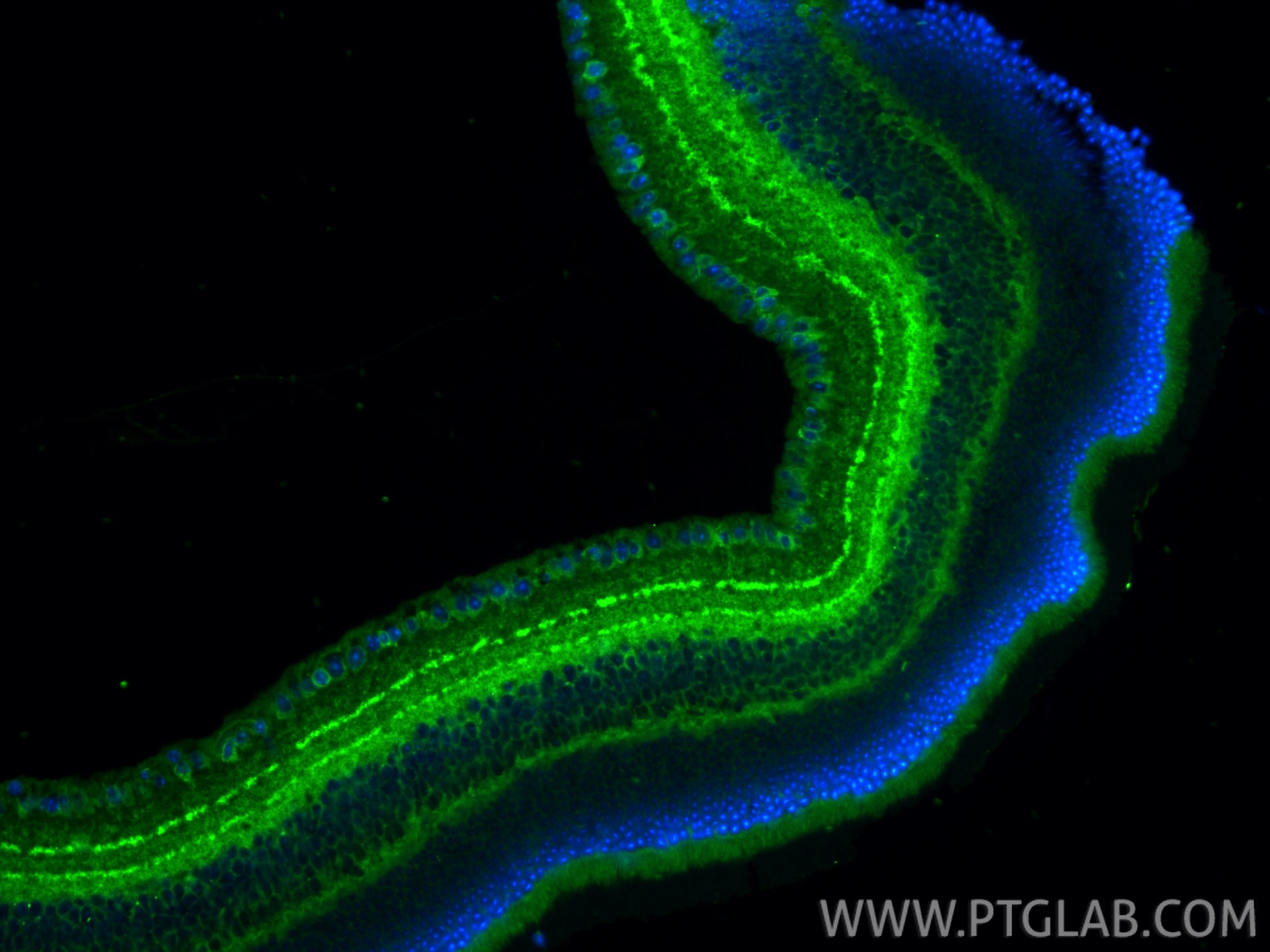 Immunofluorescence (IF) / fluorescent staining of mouse eye tissue using CACNA2D1 Polyclonal antibody (27453-1-AP)