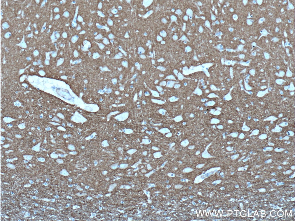 Immunohistochemistry (IHC) staining of human brain tissue using CACNA2D1 Polyclonal antibody (27453-1-AP)