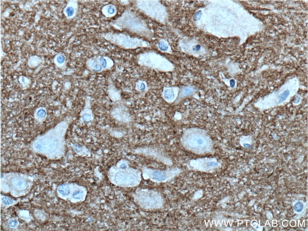 Immunohistochemistry (IHC) staining of human brain tissue using CACNA2D1 Polyclonal antibody (27453-1-AP)