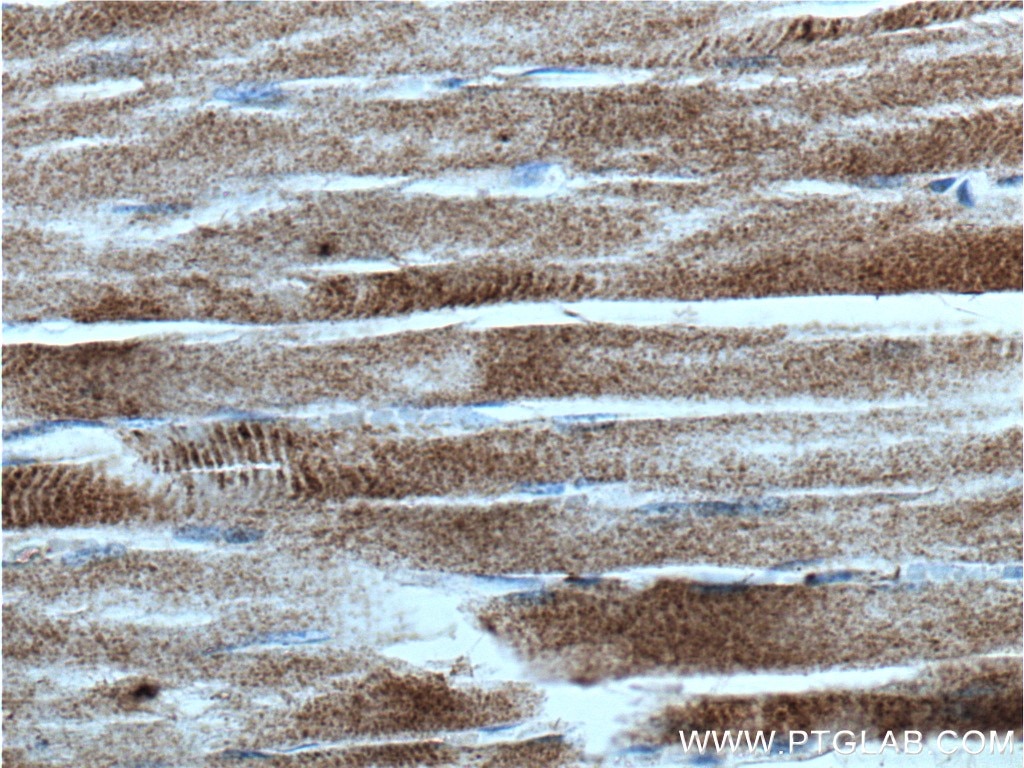 Immunohistochemistry (IHC) staining of human skeletal muscle tissue using CACNA2D1 Polyclonal antibody (27453-1-AP)