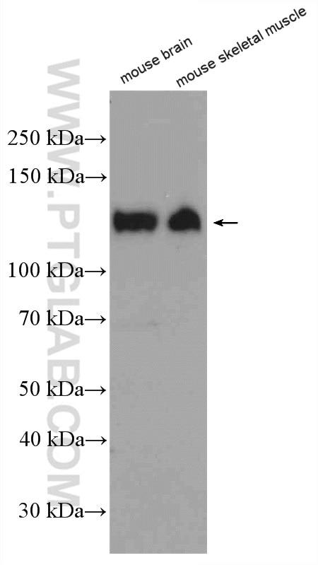 Western Blot (WB) analysis of mouse brain tissue using CACNA2D1 Polyclonal antibody (27453-1-AP)