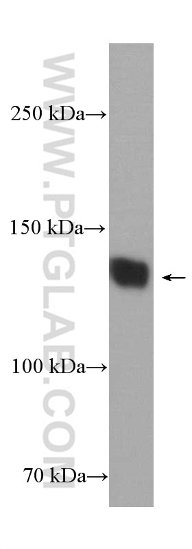 Western Blot (WB) analysis of rat brain tissue using CACNA2D1 Polyclonal antibody (27453-1-AP)