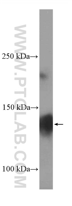 Western Blot (WB) analysis of pig brain tissue using CACNA2D1 Polyclonal antibody (27453-1-AP)