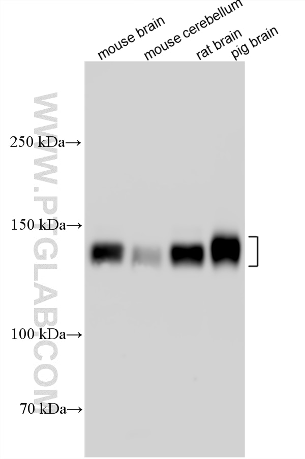 Western Blot (WB) analysis of various lysates using CACNA2D1 Polyclonal antibody (27453-1-AP)