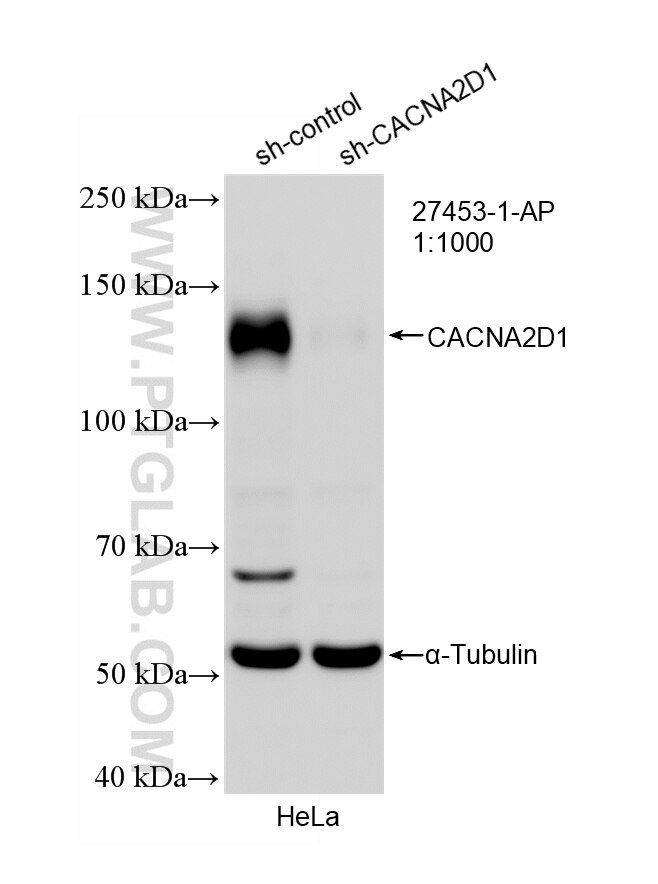 Western Blot (WB) analysis of HeLa cells using CACNA2D1 Polyclonal antibody (27453-1-AP)