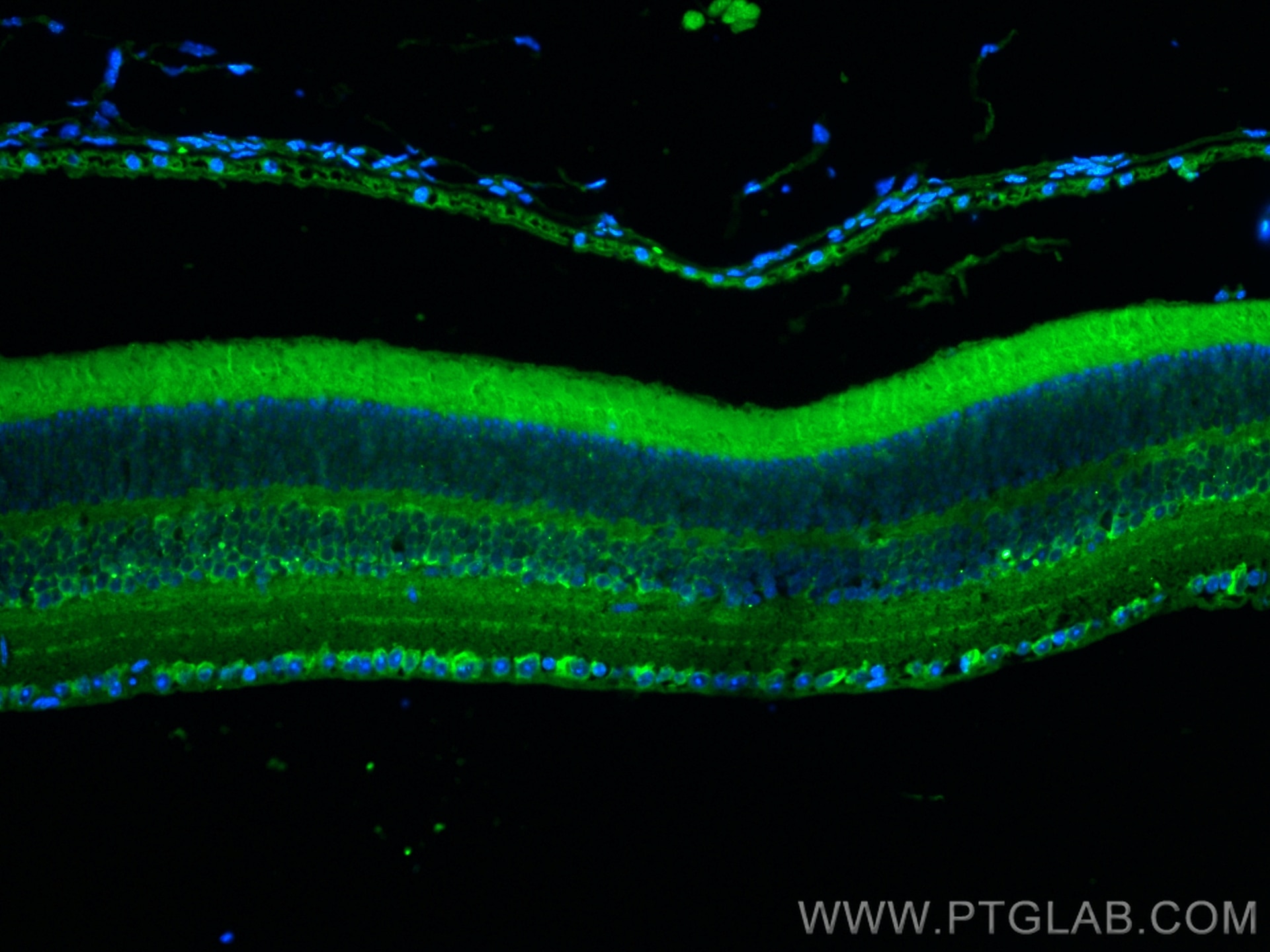 Immunofluorescence (IF) / fluorescent staining of mouse eye tissue using CoraLite® Plus 488-conjugated CACNA2D1 Polyclonal  (CL488-27453)